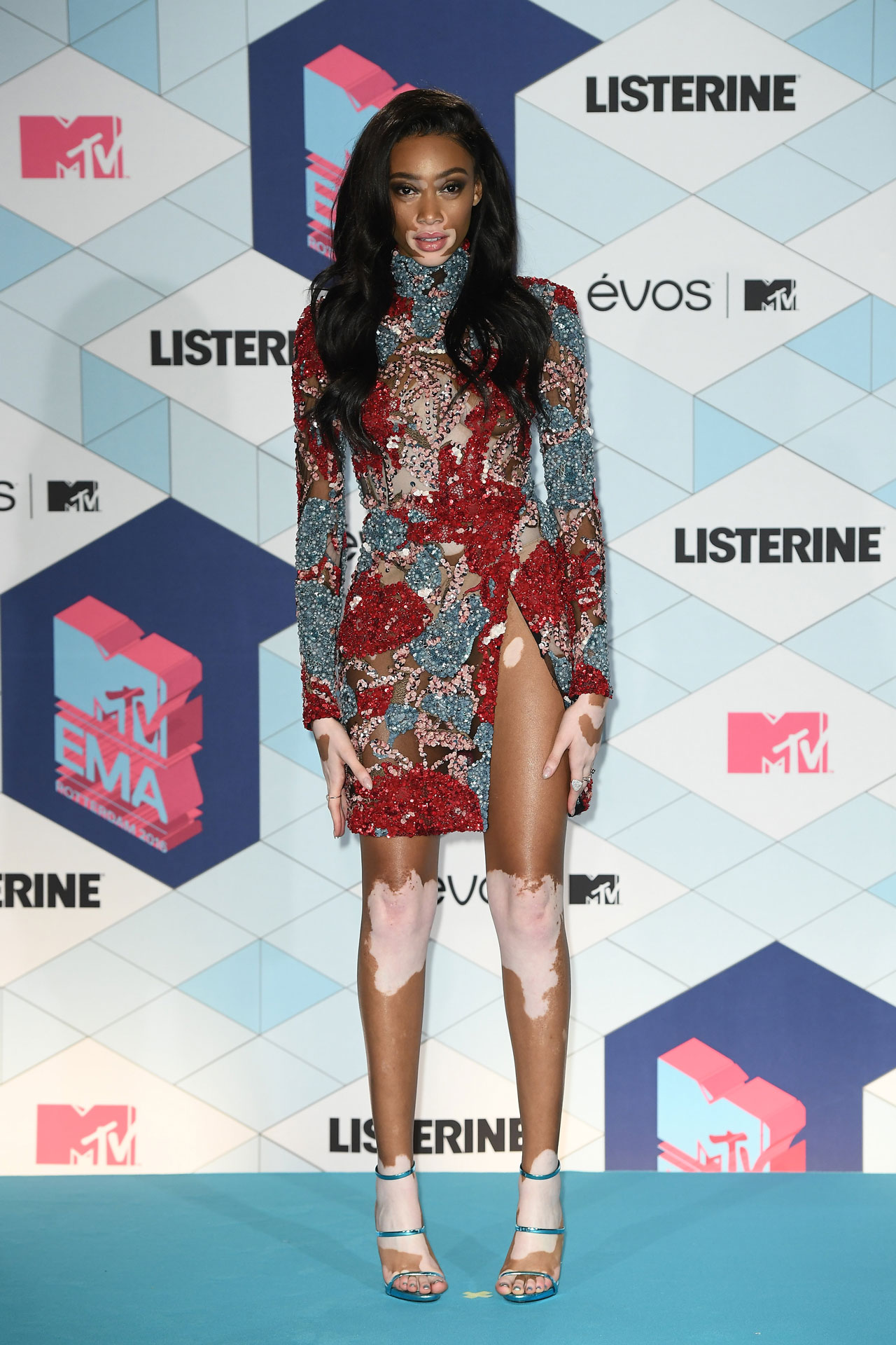 winnieharlow
