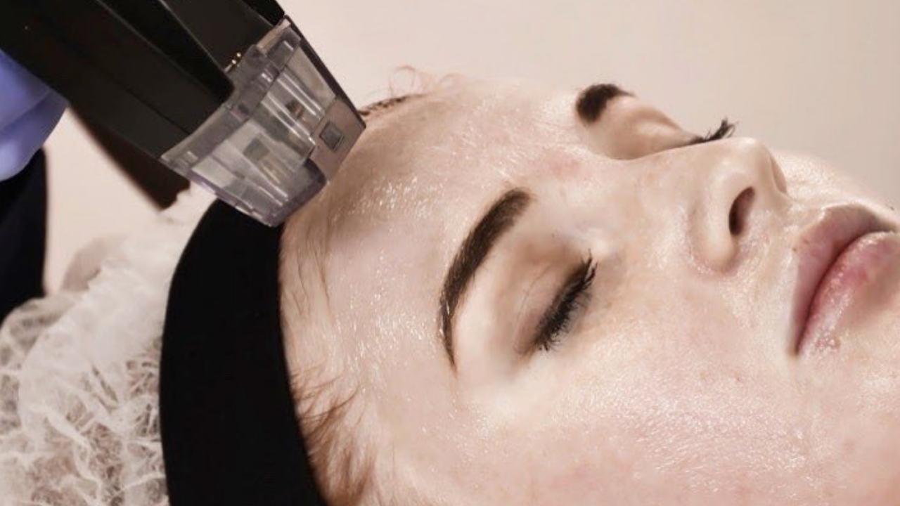 Here's Why Morpheus 8 Is The Hottest New Laser Treatment Grazia