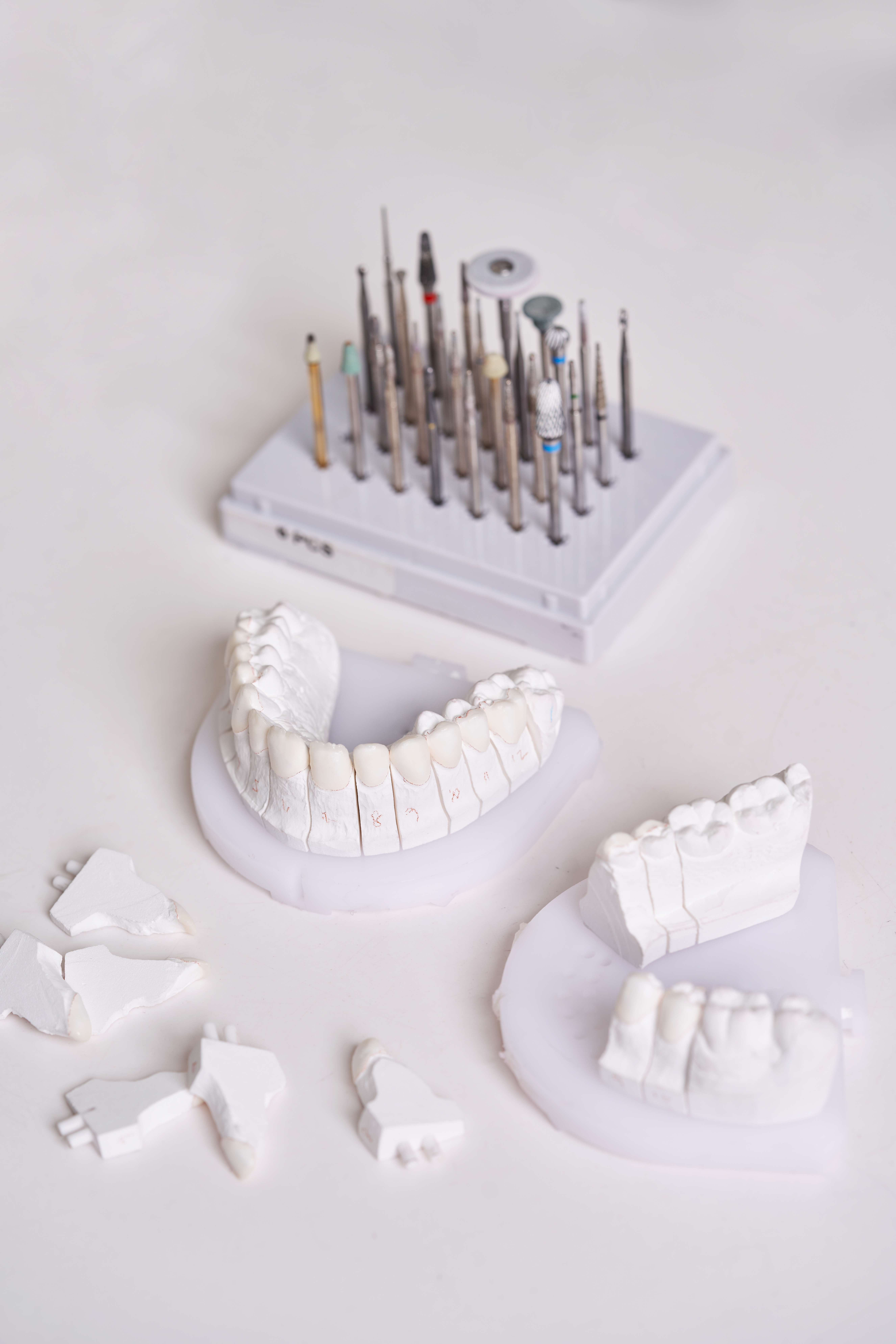 Veneers 101 Everything You Need To Know About Veneers