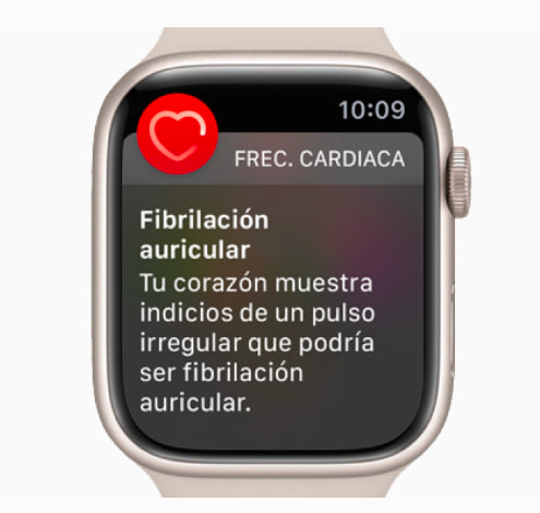 Tienes un Apple Watch? Ahora podrás hacerte un electrocardiograma desde tu  muñeca