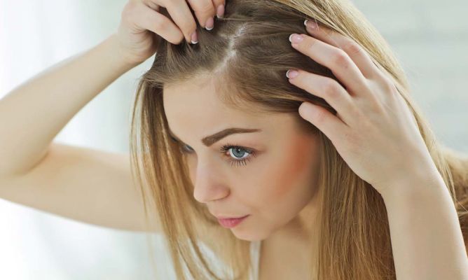 ¿Por qué se nos cae el cabello y cómo podemos disminuirlo?