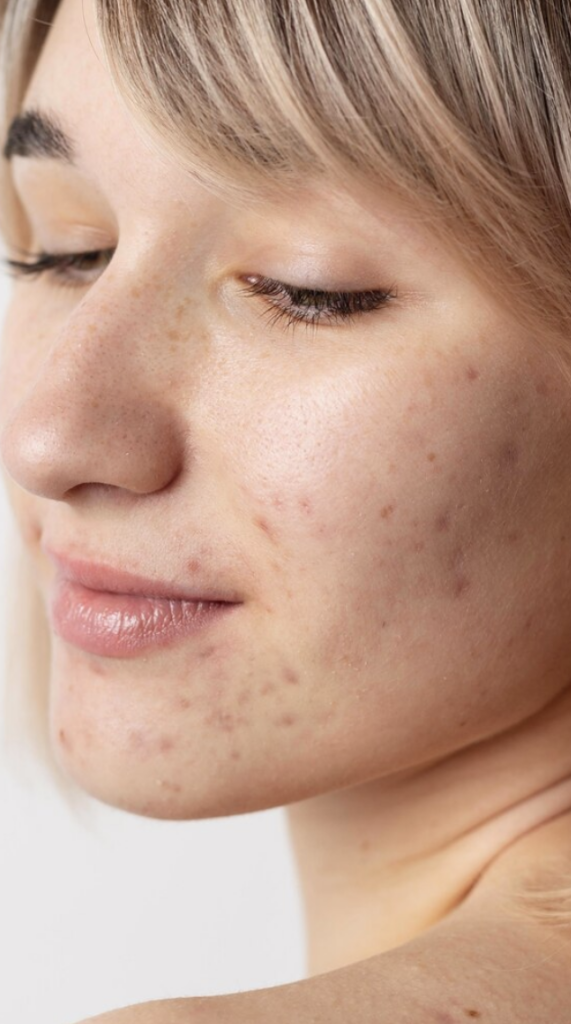 Celebra tu Piel: Día mundial del skincare