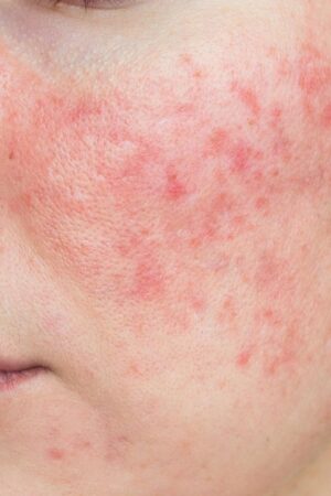 La rutina de Skincare correcta, según tu tipo de piel