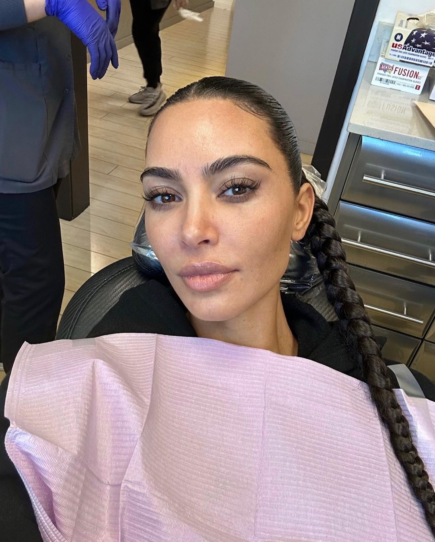 kim-kardashian-acne
